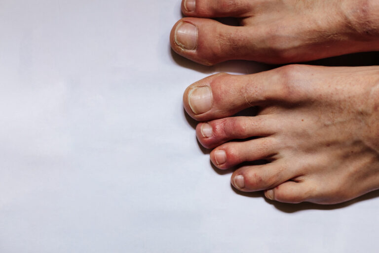 feet with toes