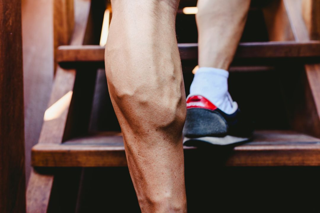 vein health myths and facts
